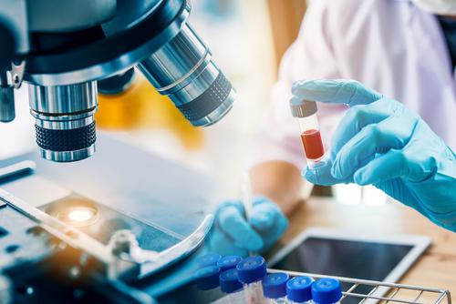 Futura Medical "very pleased" by Eroxon testing results